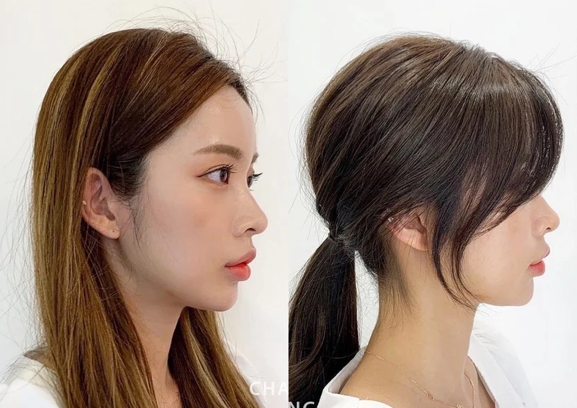 Han So Hee lộ tóc hói chỉ vì chọn sai kiểu tóc - Ảnh 8.