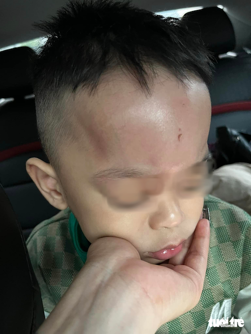 Đà Nẵng xác minh việc phụ huynh phản ánh trẻ bị bạo hành ở trường - Ảnh 1. Đà Nẵng xác minh việc phụ huynh phản ánh trẻ bị bạo hành ở trường - Ảnh 1.