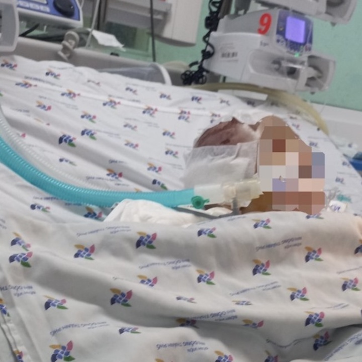 TP.HCM: Bé 6 tháng tuổi xuất huyết não nghi bị bạo hành - Ảnh 1. TP.HCM: Bé 6 tháng tuổi xuất huyết não nghi bị bạo hành - Ảnh 1.