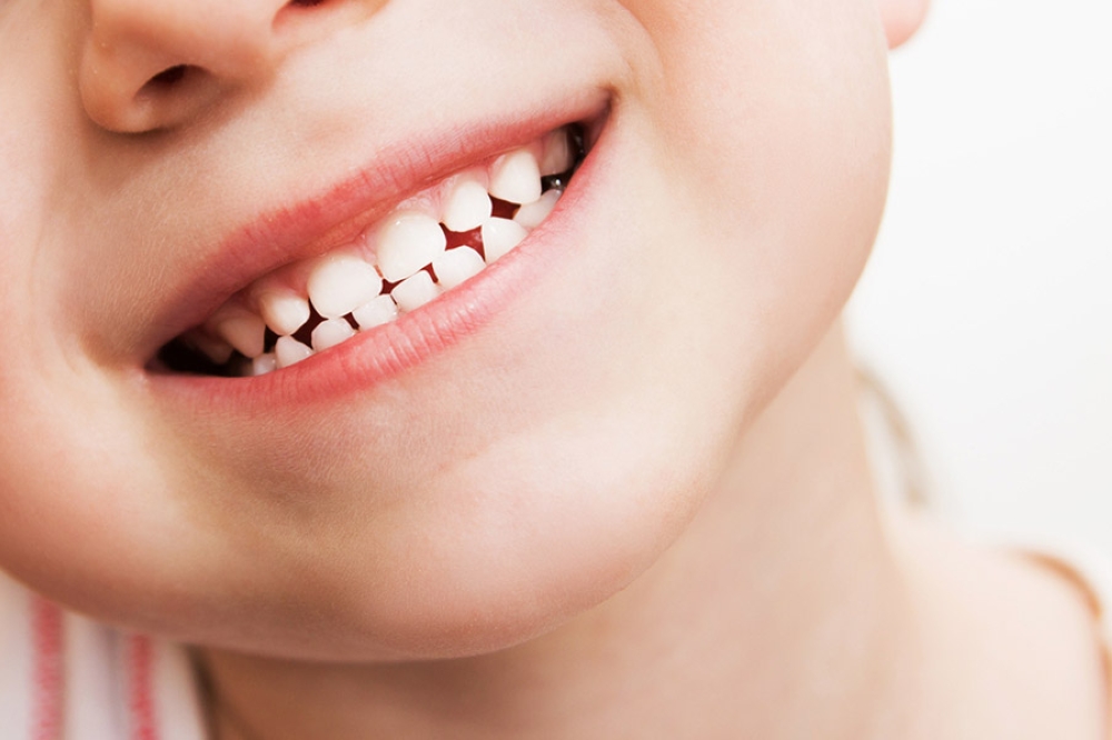 Cách khắc phục tình trạng răng trẻ bị đen khi uống sắt nước? - Ảnh 2.