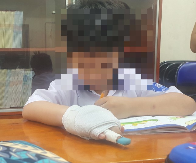 Cơ quan chức năng v&agrave;o cuộc vụ gi&aacute;o vi&ecirc;n bị tố đ&aacute;nh g&atilde;y xương ng&oacute;n tay học sinh - Ảnh 1.