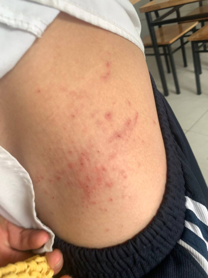Hàng trăm hộ dân chung cư ở Hà Nội yêu cầu làm rõ nguồn nước sạch gây mẩn ngứa - Ảnh 2. Hàng trăm hộ dân chung cư ở Hà Nội yêu cầu làm rõ nguồn nước sạch gây mẩn ngứa - Ảnh 2.
