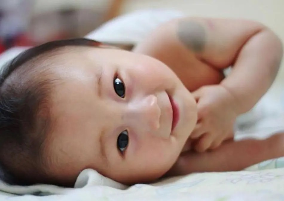 Em bé chào đời với 1 vết bớt độc nhất vô nhị