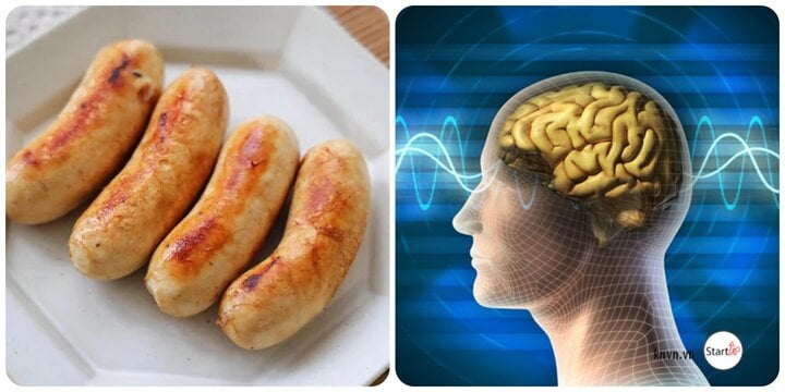 5 loại thực phẩm có hại cho não nhưng nhiều người vẫn hồn nhiên ăn - Ảnh 1.