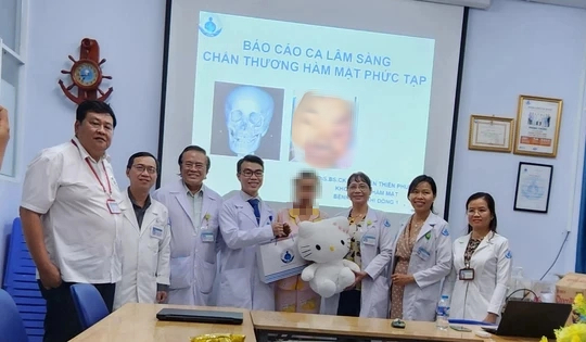 Bác sĩ xuyên đêm phẫu thuật cứu bé gái đa chấn thương vùng mặt vì tai nạn giao thông - Ảnh 2.