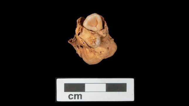 Bí ẩn cô gái Ai Cập 3.000 tuổi mọc răng trong bụng - Ảnh 1.