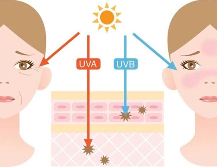 Làm thế nào để bảo vệ da dưới ánh mặt trời? - Ảnh 1.