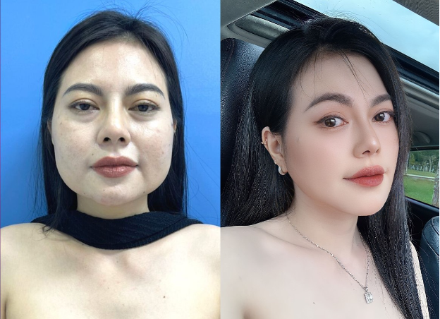 Chuyên khoa thẩm mỹ Hồng Hà - Kiến tạo nhan sắc toàn diện không phân biệt giới tính - Ảnh 6. Chuyên khoa thẩm mỹ Hồng Hà - Kiến tạo nhan sắc toàn diện không phân biệt giới tính - Ảnh 6.
