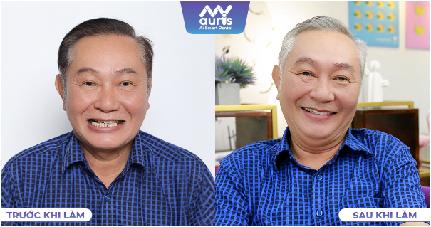 Nghệ sĩ Đ&agrave;o Anh Tuấn tiết lộ b&iacute; quyết gi&uacute;p nụ cười ở tuổi U70 vẫn lu&ocirc;n khoẻ mạnh - Ảnh 5.