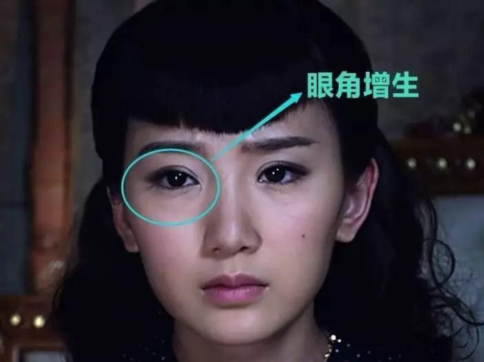 Một sao nữ xinh như &quot;tiên tử&quot; ở sự kiện, nhưng netizen chỉ đổ xô zoom cận 1 chi tiết bất thường trên gương mặt - Ảnh 6.