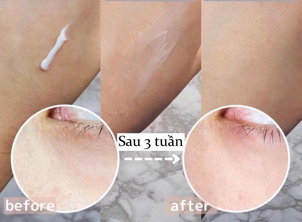 Phạm Băng Băng, Triệu Vy… đều tin dùng loại kem mắt ngừa lão hóa đỉnh cao - Ảnh 9.