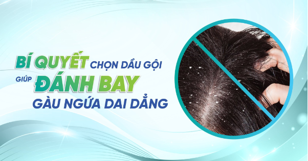 Gợi ý cách chọn dầu gội đầu giúp đánh bay gàu ngứa - Ảnh 1.