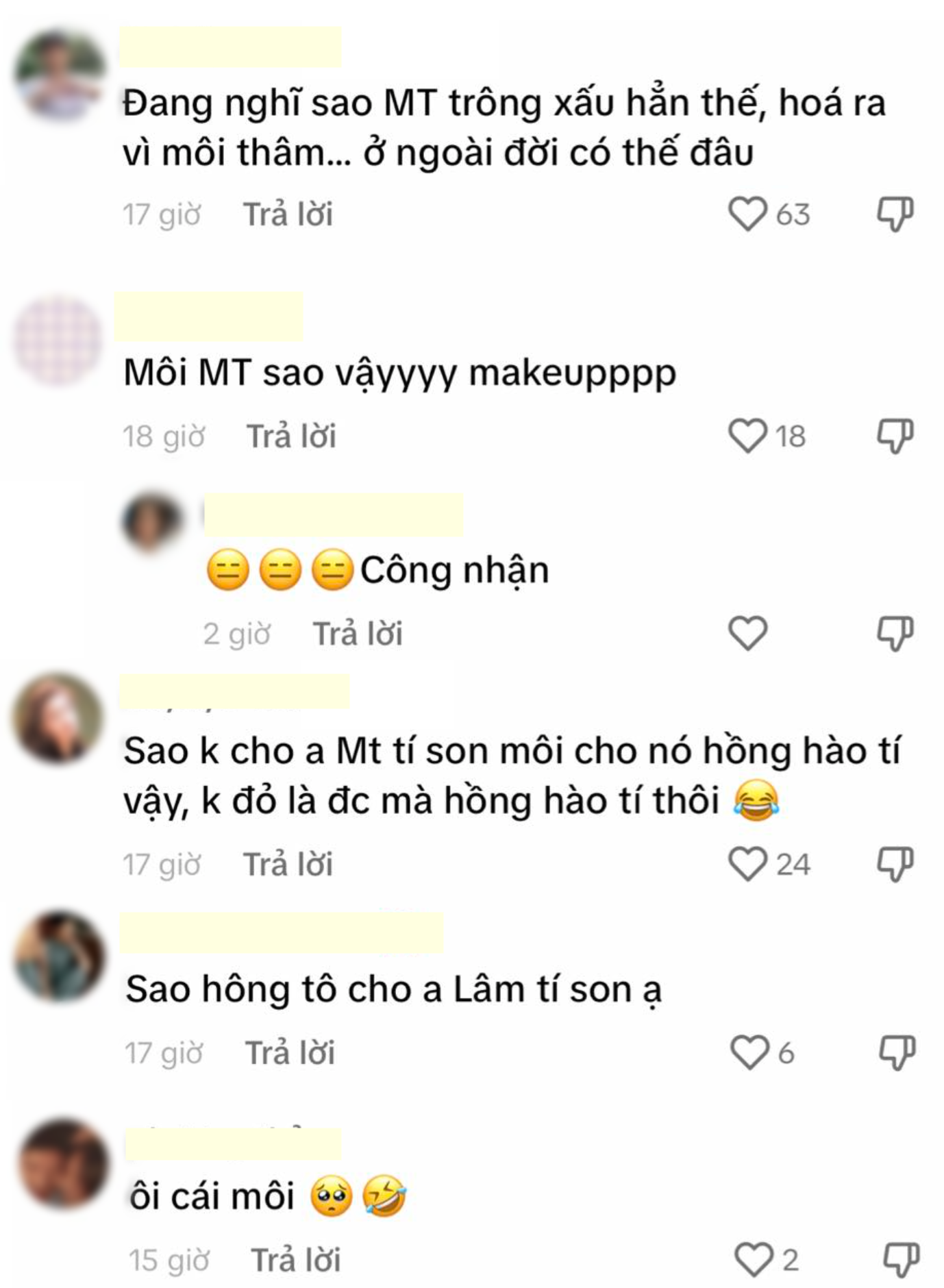 Mỹ nam phim Việt giờ vàng bất ngờ bị chê nhan sắc chỉ vì một đặc điểm, netizen thấy mà &quot;bất bình thay&quot; - Ảnh 5.