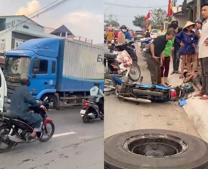 Nam thanh ni&ecirc;n bất tỉnh v&igrave; bị b&aacute;nh &ocirc; t&ocirc; văng tr&uacute;ng người - Ảnh 1.