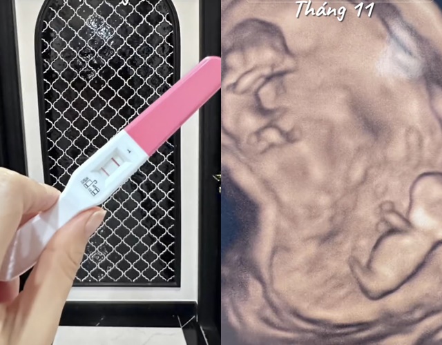 Phương Oanh tiết lộ hình siêu âm song thai, khoe một năm viên mãn khiến netizen ghen tị - Ảnh 2.