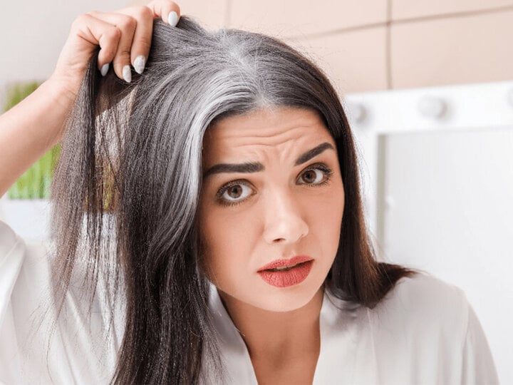 Cần làm gì để ngăn tóc bạc sớm? - Ảnh 2.