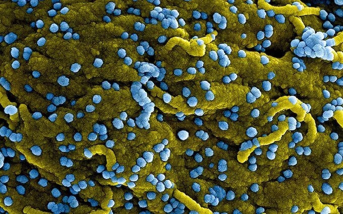 Virus Marburg gây sốt xuất huyết nguy hiểm thế nào? - Ảnh 1.