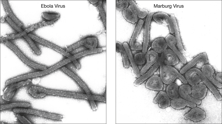 Virus Marburg và Ebola giống nhau không? - Ảnh 3.