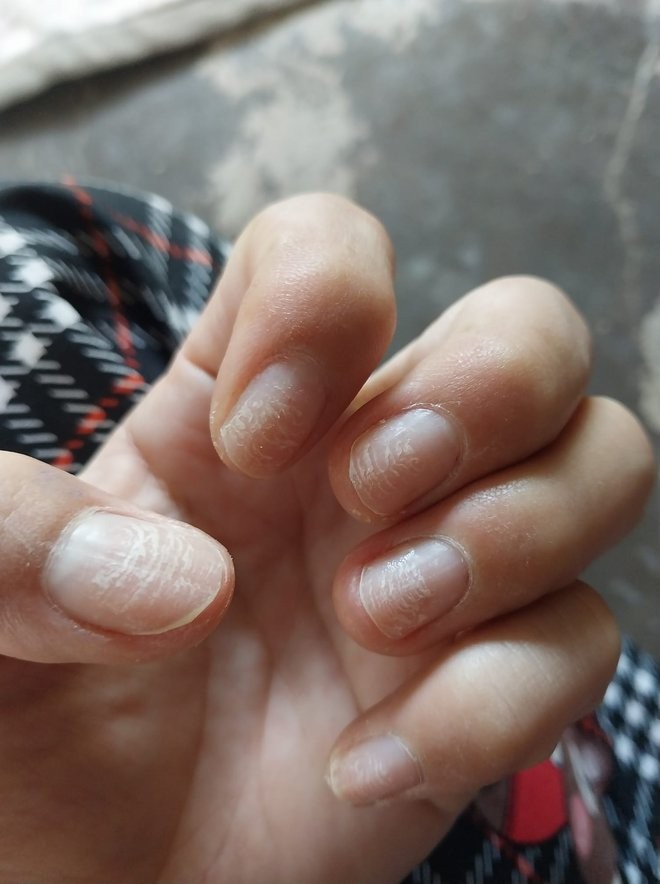 Sự thật kinh hoàng dưới những bộ nail xinh lung linh của hội chị em - Ảnh 15.