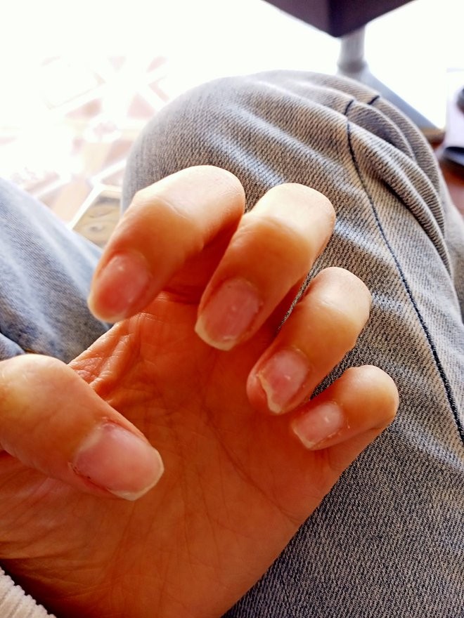 Sự thật kinh hoàng dưới những bộ nail xinh lung linh của hội chị em - Ảnh 4.