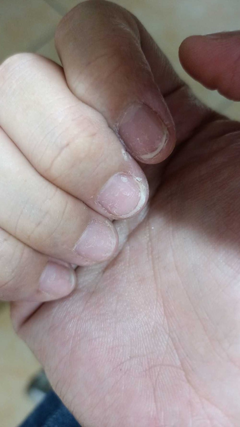 Sự thật kinh hoàng dưới những bộ nail xinh lung linh của hội chị em - Ảnh 1.