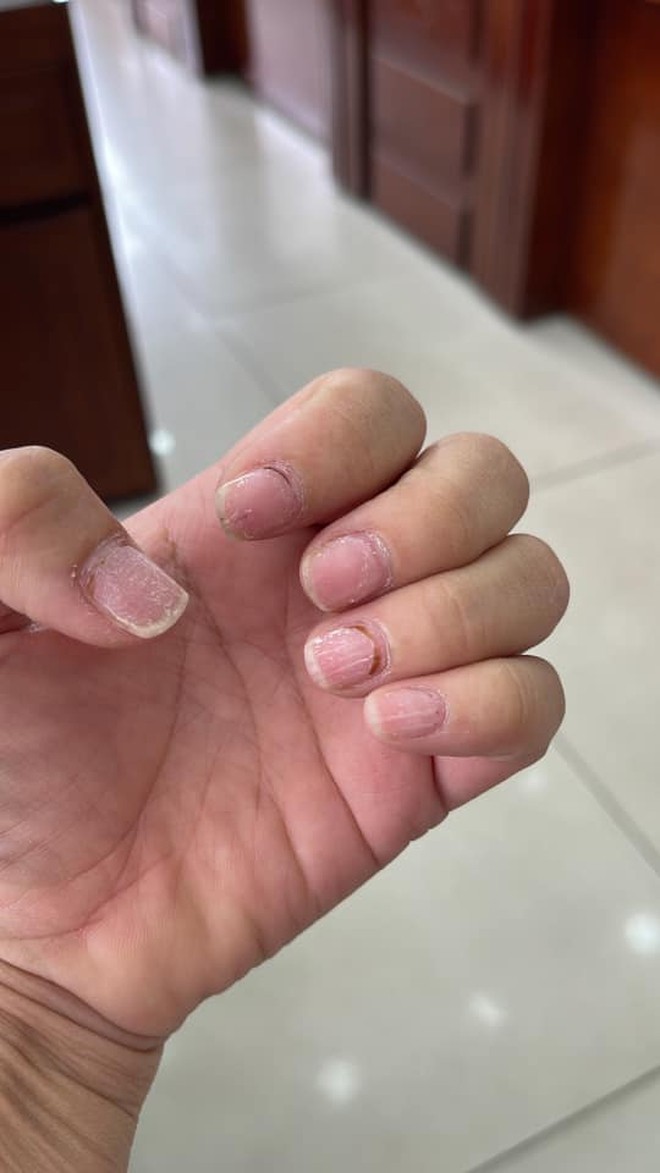 Sự thật kinh hoàng dưới những bộ nail xinh lung linh của hội chị em - Ảnh 14.