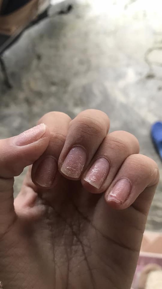 Sự thật kinh hoàng dưới những bộ nail xinh lung linh của hội chị em - Ảnh 13.