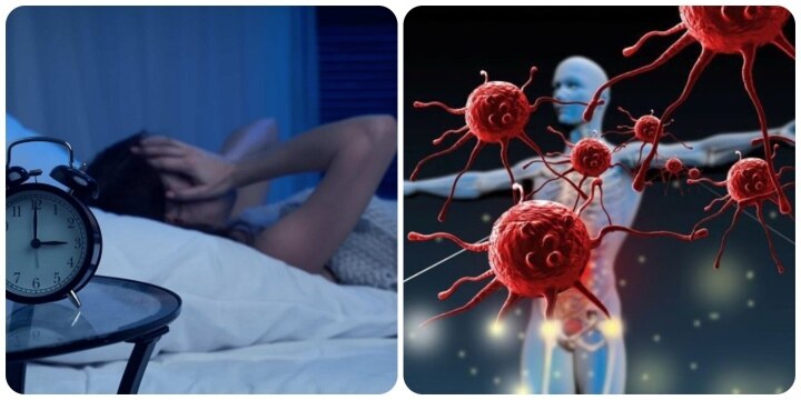 5 bất thường khi ngủ ban đêm là dấu hiệu ung thư - Ảnh 1.