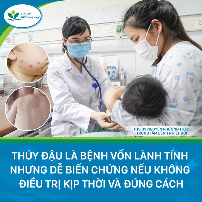 Bác sĩ hướng dẫn cách chăm sóc trẻ mắc bệnh thủy đậu - Ảnh 1.