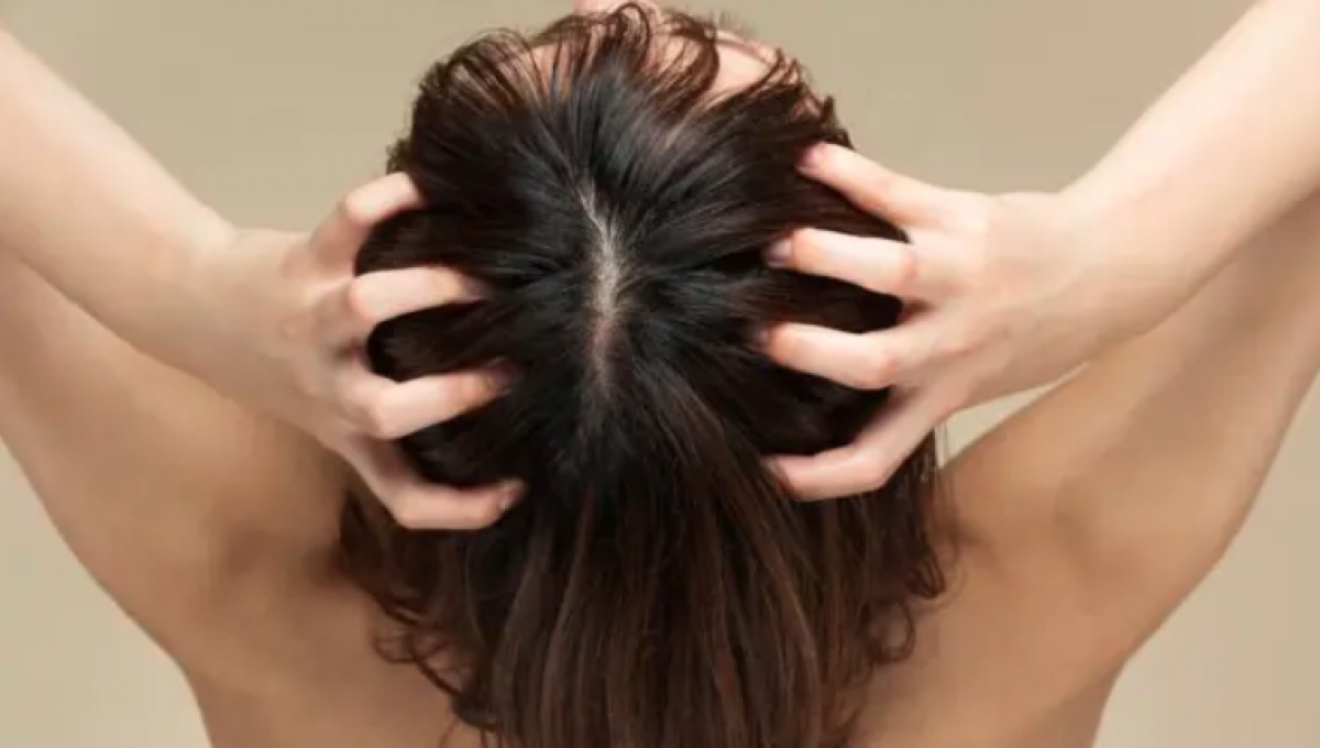 Biện pháp giúp tóc mọc nhanh hơn tại nhà - Ảnh 7.