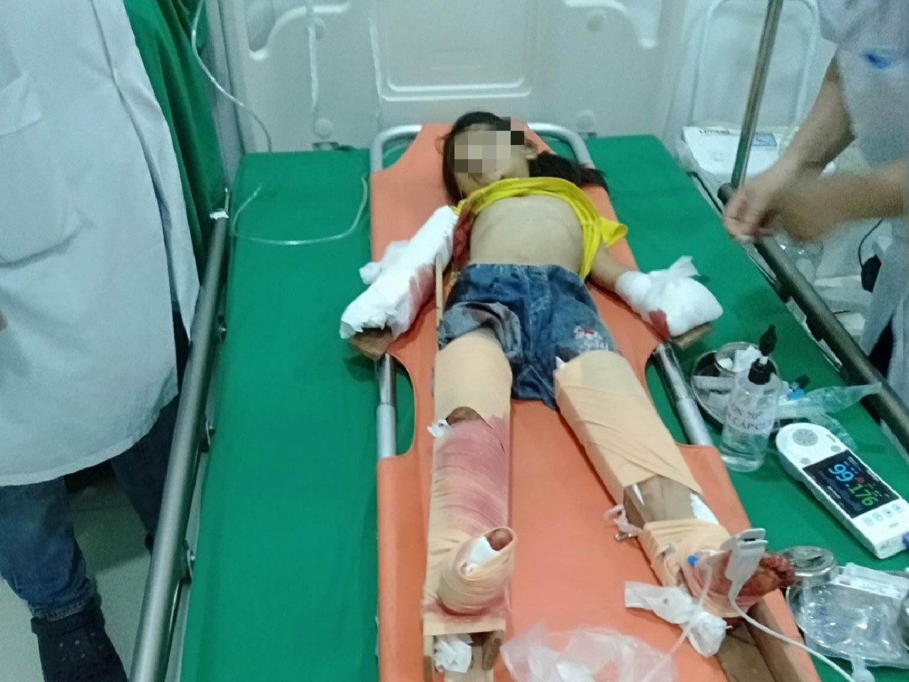Thông tin mới vụ nổ gara ở Nghệ An: Thêm một nạn nhân tử vong, 3 cháu nhỏ bị thương là con trong một gia đình - Ảnh 2.
