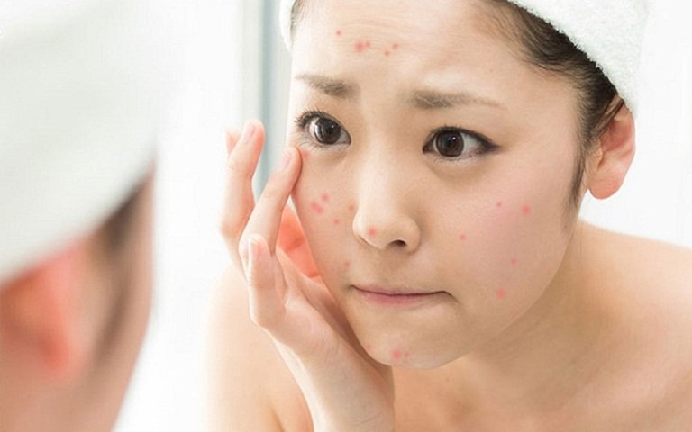 Các thành phần gây mụn có trong mỹ phẩm chị em cần tránh - Ảnh 7. Các thành phần gây mụn có trong mỹ phẩm chị em cần tránh - Ảnh 7.