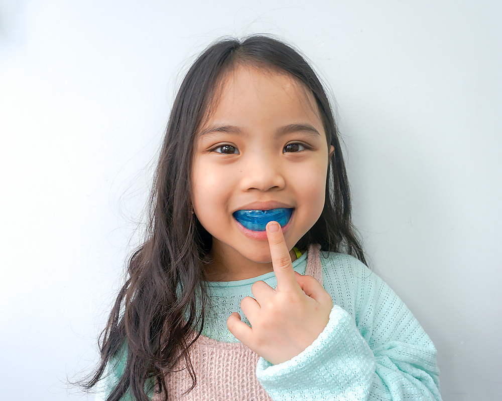 3 vấn đề quyết định niềng răng cho trẻ thành công, cha mẹ muốn thay đổi diện mạo cho con cần nắm đủ - Ảnh 3.