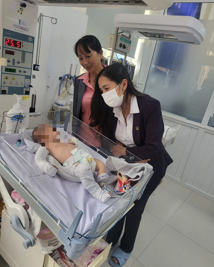 5 lần bị bạo hành dã man khiến bé gái 2 tháng tuổi chấn thương sọ não, gãy đa xương - Ảnh 2. 5 lần bị bạo hành dã man khiến bé gái 2 tháng tuổi chấn thương sọ não, gãy đa xương - Ảnh 2.