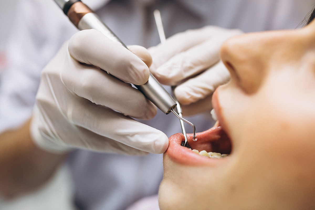 Nhổ răng khôn an toàn: Tiết lộ quy trình thực hiện tránh biến chứng - Ảnh 3.