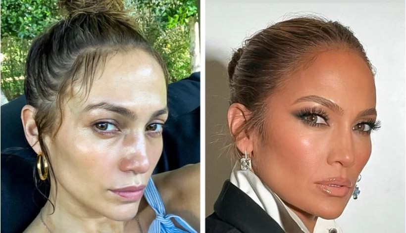 Adele, Lady Gaga tự tin khoe &lsquo;mặt mộc&rsquo; nhiều khuyết điểm - Ảnh 3.