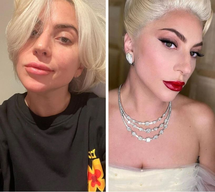Adele, Lady Gaga tự tin khoe &lsquo;mặt mộc&rsquo; nhiều khuyết điểm - Ảnh 2.