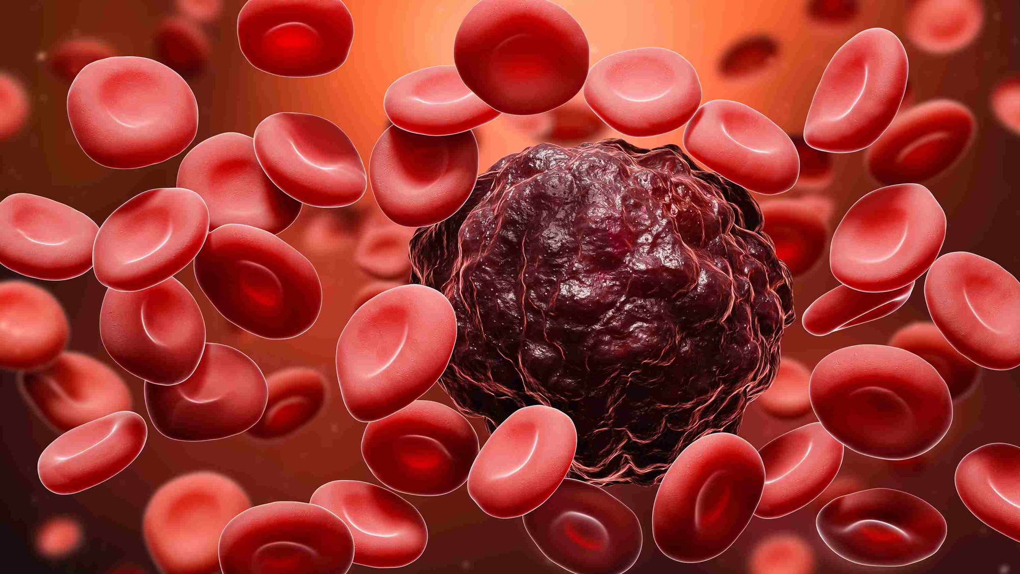 types-of-blood-cancer11zon-1686304687743-16863046878441225463281-1686313509507-16863135096222041706082.jpg