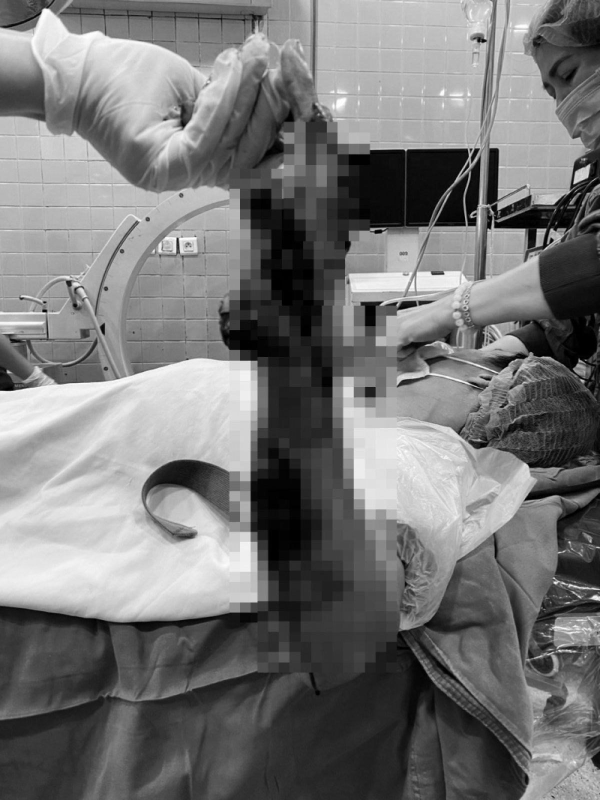 Phẫu thuật khẩn trong đêm cứu bàn tay bị máy cưa nghiền nát - Ảnh 1.