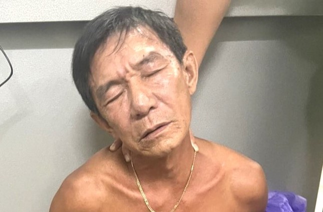 Đâm bạn trọng thương vì xin ngưng nhậu giữa chừng - Ảnh 1. Đâm bạn trọng thương vì xin ngưng nhậu giữa chừng - Ảnh 1.
