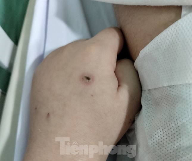 Vụ học sinh lớp 4 tử vong bất thường ở Hải Dương: Pháp y kết luận có tổn thương phù hợp do rò điện - Ảnh 3. Vụ học sinh lớp 4 tử vong bất thường ở Hải Dương: Pháp y kết luận có tổn thương phù hợp do rò điện - Ảnh 3.