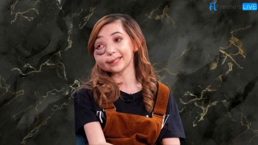 Bị chế giễu là "quái vật", bé gái vượt lên nghịch cảnh trở thành niềm tự hào của nước Anh, kiếm tiền tỷ mỗi năm - Ảnh 8. Bị chế giễu là "quái vật", bé gái vượt lên nghịch cảnh trở thành niềm tự hào của nước Anh, kiếm tiền tỷ mỗi năm - Ảnh 8.