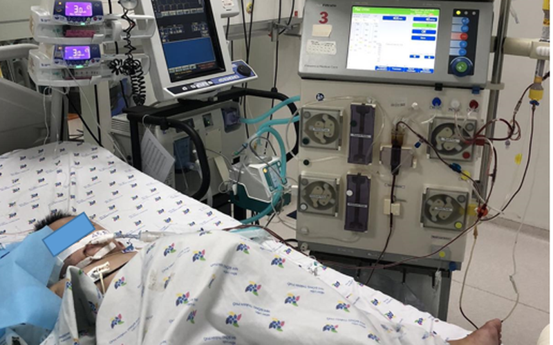 Cứu bé trai 2 tuổi sốc sốt xuất huyết nặng, tổn thương gan, suy đa cơ quan - Ảnh 1. Cứu bé trai 2 tuổi sốc sốt xuất huyết nặng, tổn thương gan, suy đa cơ quan - Ảnh 1.