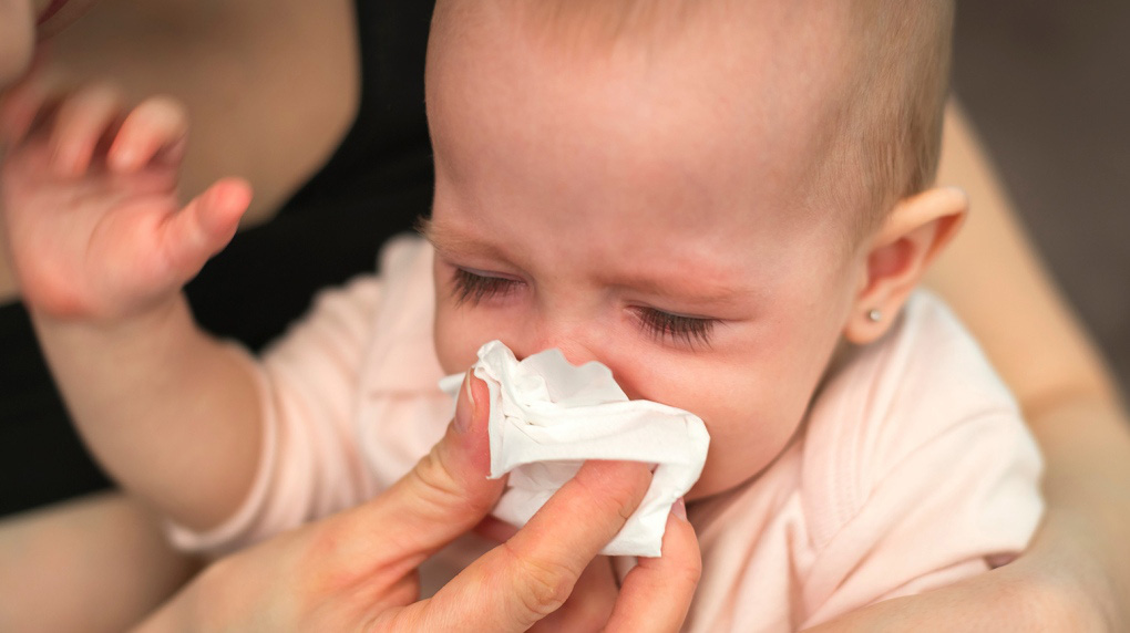 Virus hợp bào hô hấp gây ra 1/50 trường hợp tử vong ở trẻ em dưới 5 tuổi - Ảnh 1.