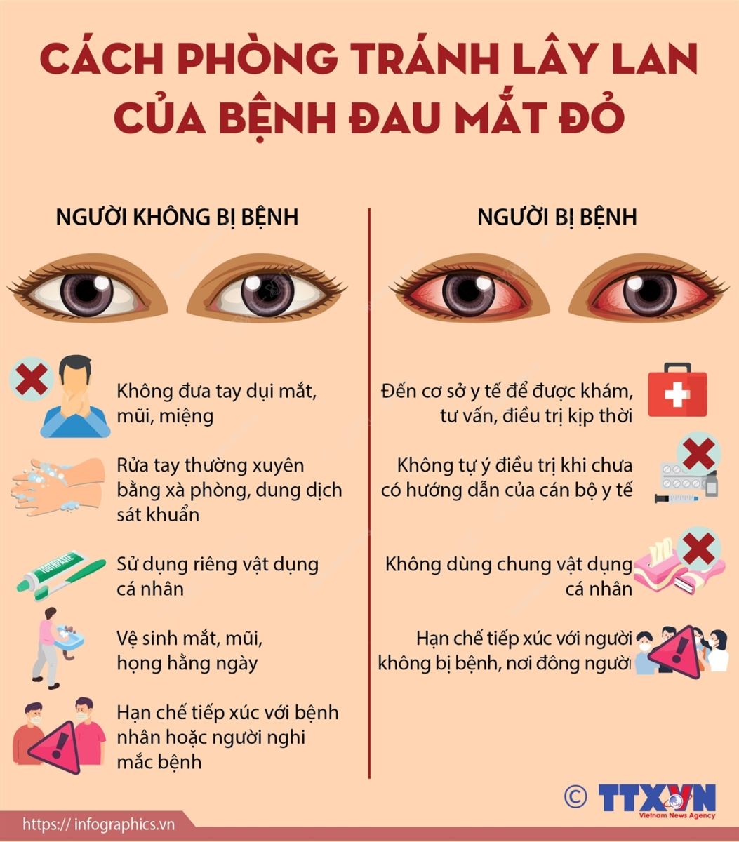 Cách phòng tránh lây lan của bệnh đau mắt đỏ