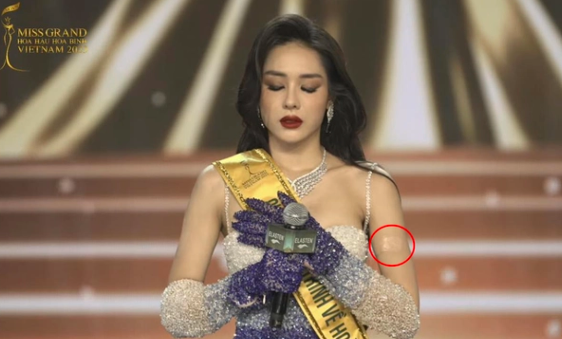 Bị phát hiện dùng thủ thuật che hình xăm tại Miss Grand Vietnam, Á hậu Hồng Hạnh nói gì? - Ảnh 1.