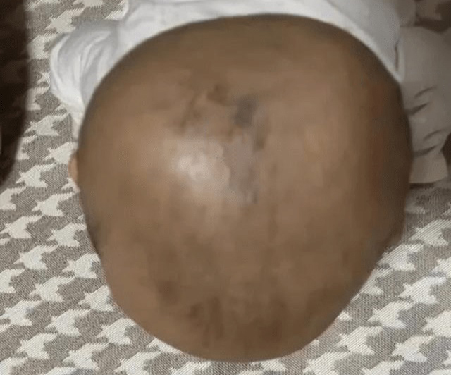 Mẹ lo lắng con mắt to mắt nhỏ, cư dân mạng nhìn qua vội khuyên tới bệnh viện khám bộ phận này - Ảnh 1. Mẹ lo lắng con mắt to mắt nhỏ, cư dân mạng nhìn qua vội khuyên tới bệnh viện khám bộ phận này - Ảnh 1.