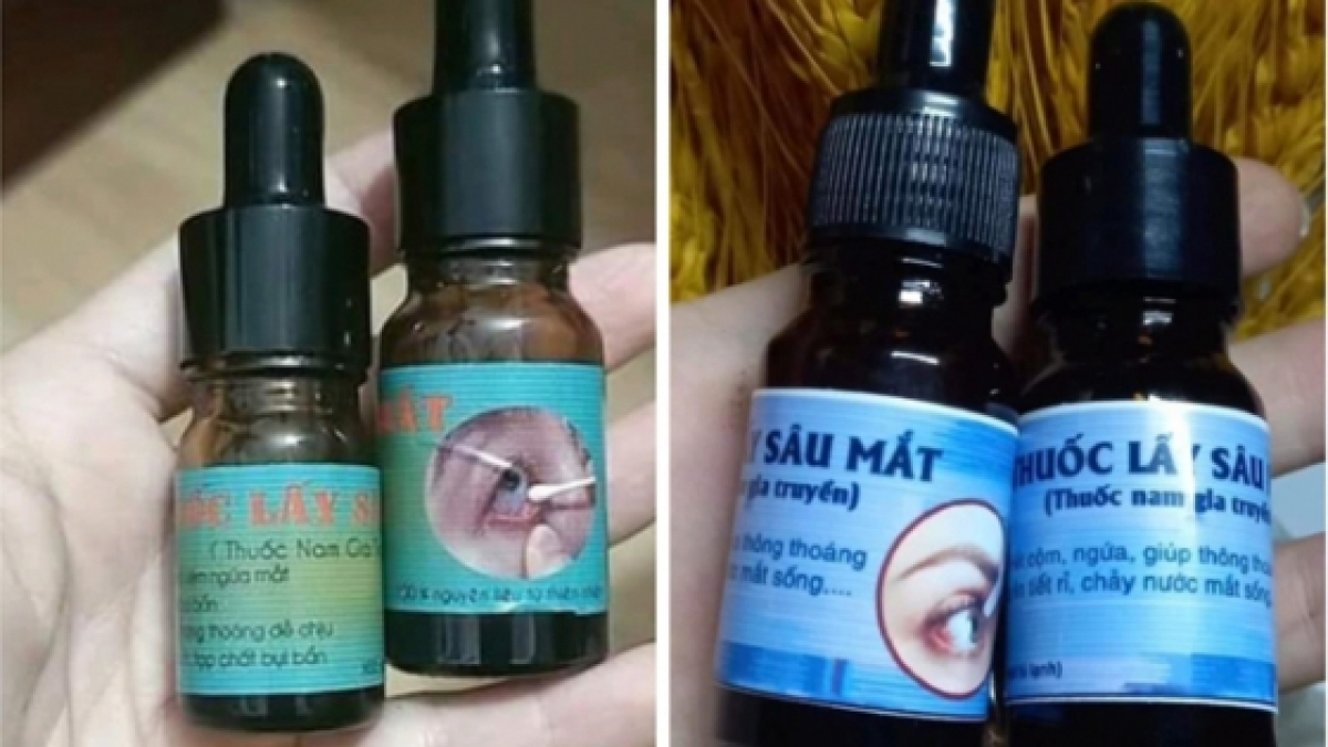 B&aacute;c sĩ n&oacute;i g&igrave; về dịch vụ &ldquo;bắt s&acirc;u mắt đang nở rộ? - Ảnh 3.