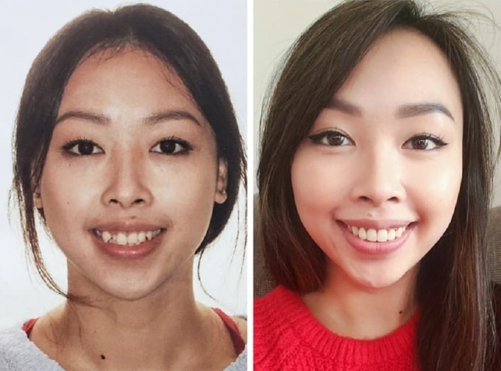 20 photos prove how braces change your smile - Photo 7.