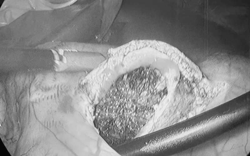 Bé gái nhập viện vì hội chứng thích ăn tóc - Ảnh 1. Bé gái nhập viện vì hội chứng thích ăn tóc - Ảnh 1.